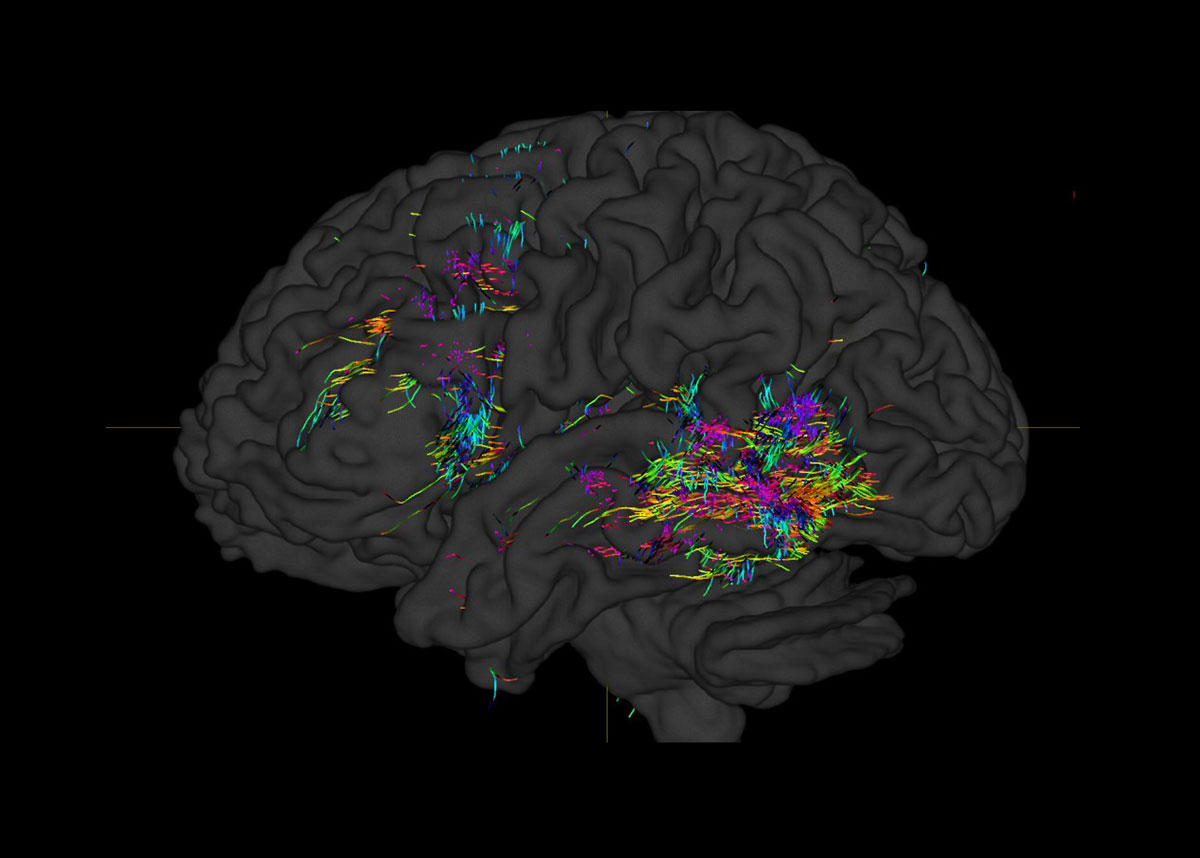 Brain Roads Colors software prototype - ÉSAD de Reims - Cluster Matters of Activity Télécom SudParis - IP Paris 2020